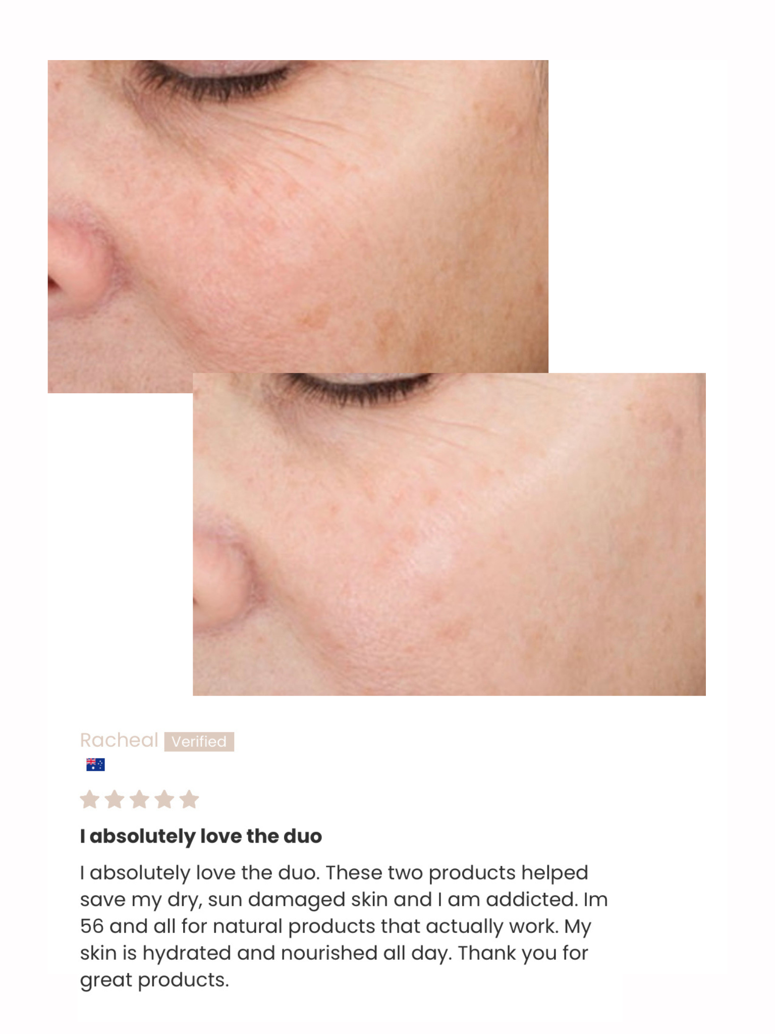 radiance-bakuchiol-face-balm-stick-vegan.jpg
Alt text: Radiance Bakuchiol face balm stick, vegan, for sensitive skin